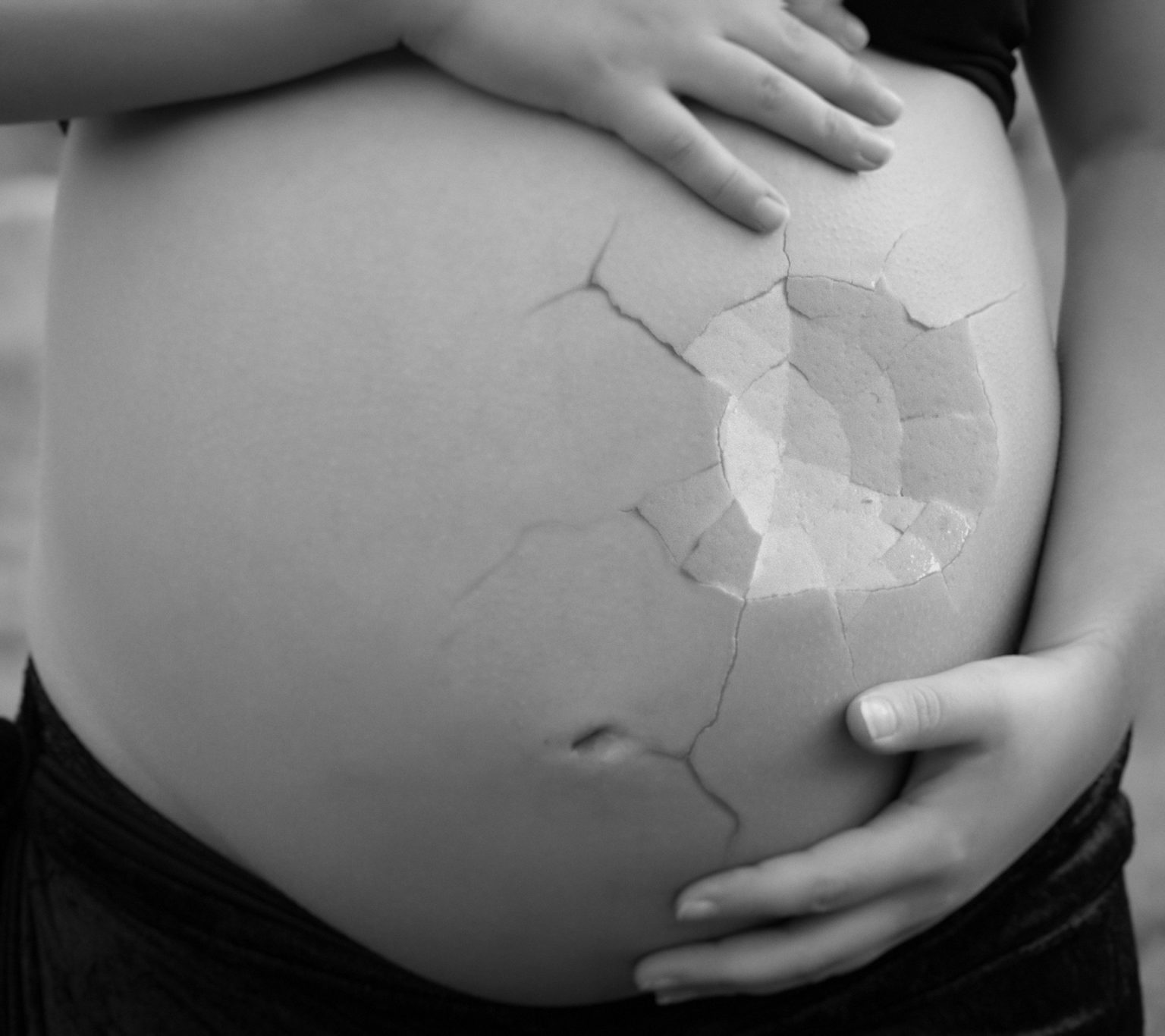 Wat is een miskraam? Baby inspiratie